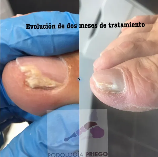 Évolution · 04