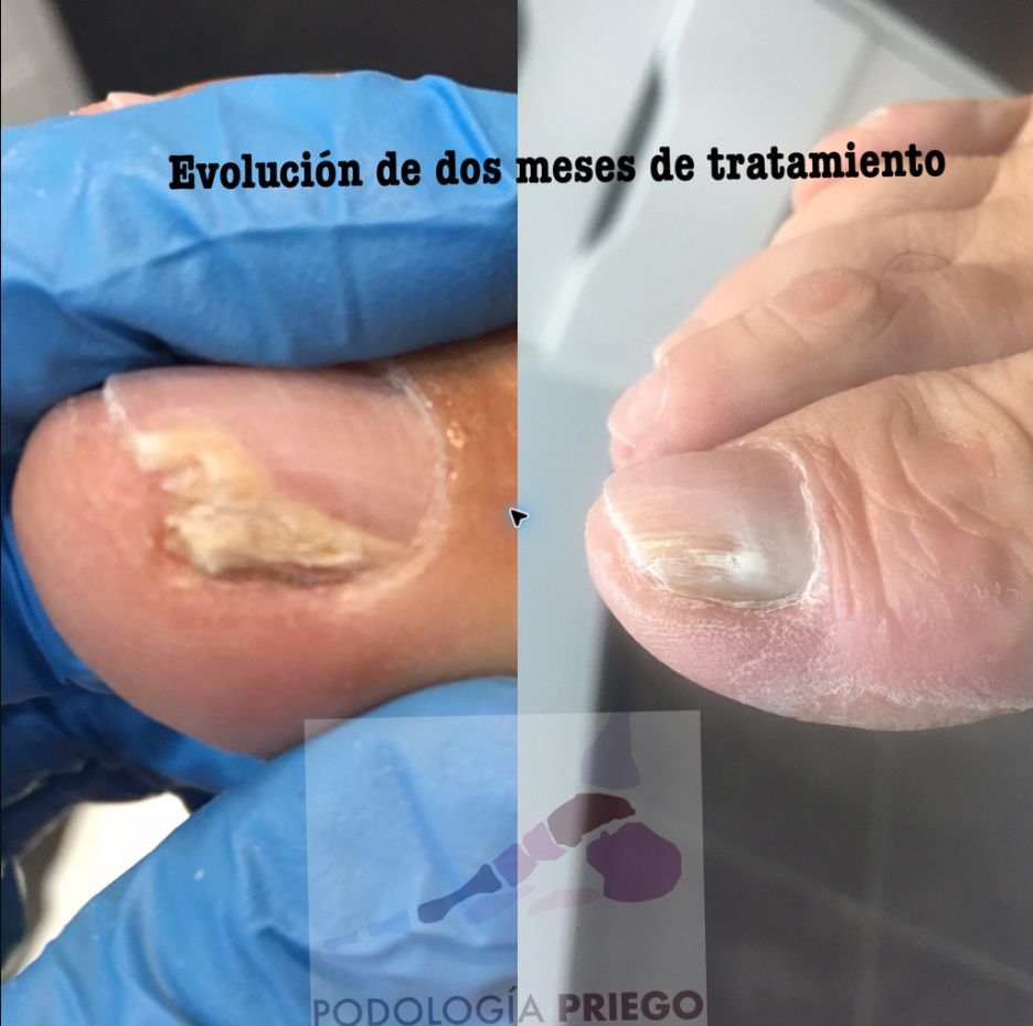 Evolución · 04